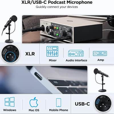XLR/USB Dynamic Recording Microphone for Singing, Metal Studio Music Recording Microphone with Mic Gain, Desktop Stand, Pop Filter, Headphone Jack, for PC, Audio Interface, Mixer, for YouTube Video image 3