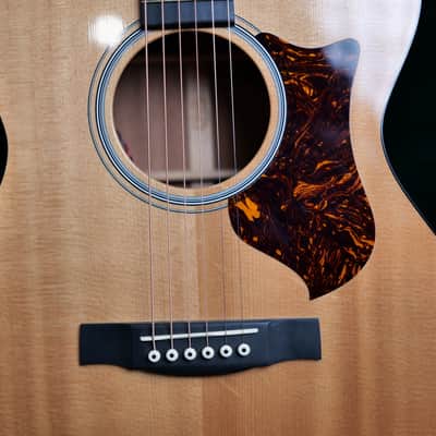 Martin OMCPA4 – Rosewood Acoustic/Electric – Excellent – Hard Case image 3