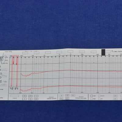 Rare EMT TSD 15 LZi MC Cartridge In Excellent Condition image 15