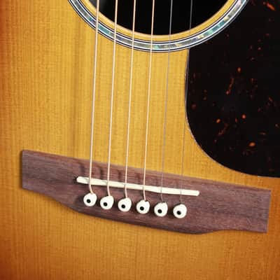 Martin D-X2E Ziricote Burst X Series Solid Top Guitar image 18