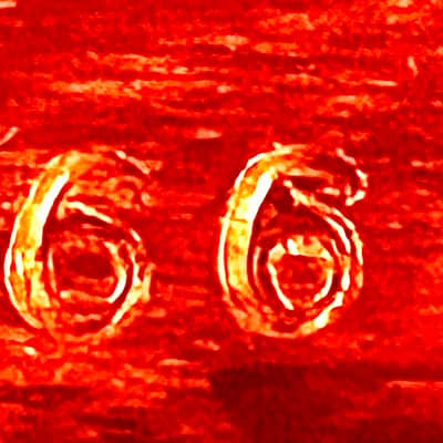 OME Juggernaut II 5 String Banjo 1983 image 9