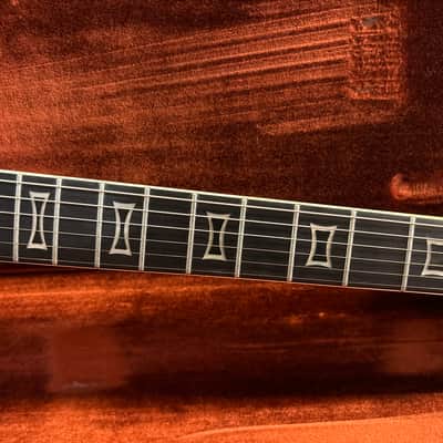 Ovation UK II 1979 - Black image 11