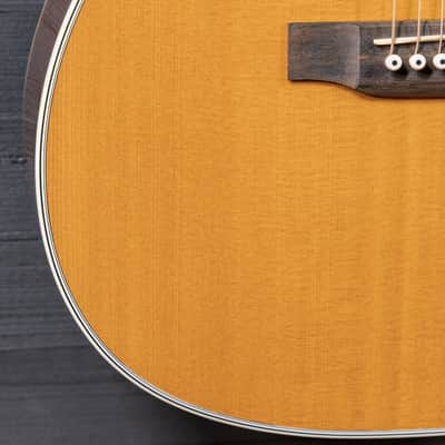 Martin OMC-28E c.2006 Standard Series w/ Fishman Aura image 17