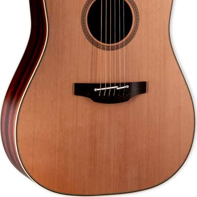 Takamine FN15 AR Limited Amazon Rosewood Acoustic-Electric Guitar w/ Case image 2