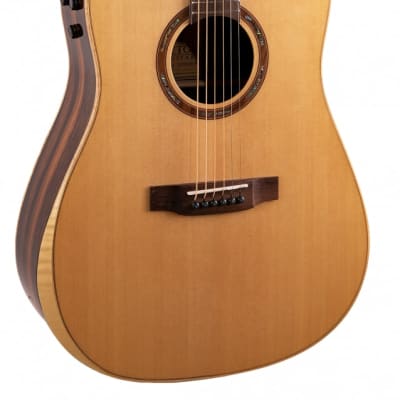 Teton STS180CENT-AR Dreadnought, Solid Spruce Top, ebony back & sides, Armrest, Fishman Flex Electro, Mint image 5