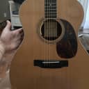 Martin 000-16 RGT with LR BAGGS ANTHEM